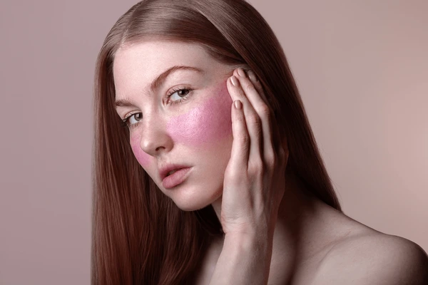 Rosacea Treatment in Lucknow